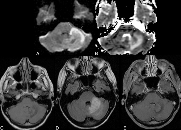 Fig 2.