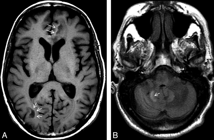 Fig 3.