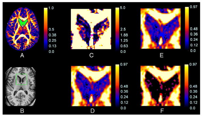 Fig. 4