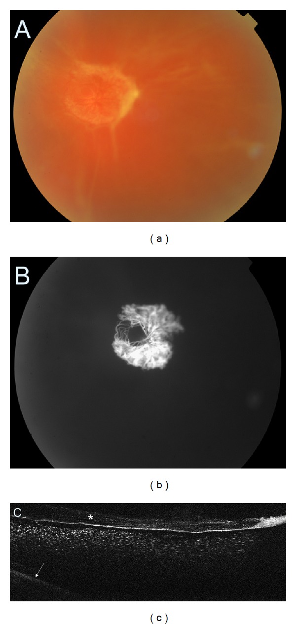 Figure 12