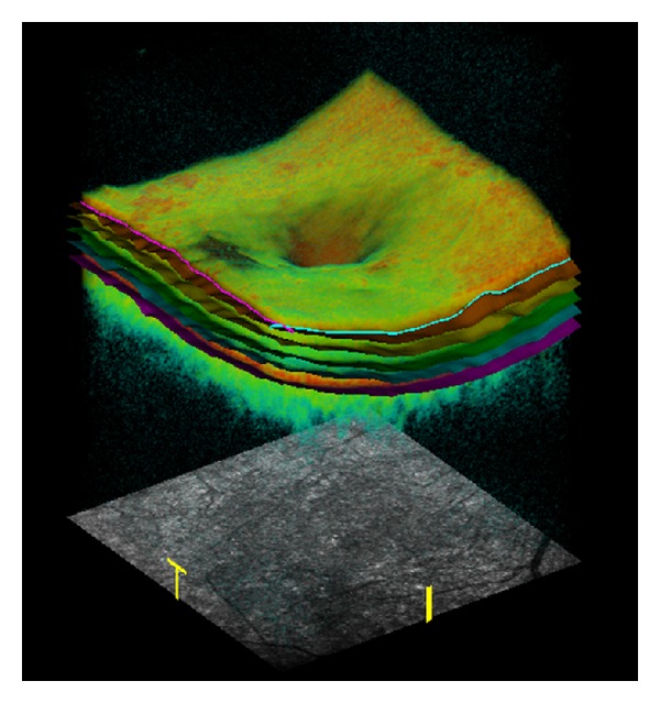 Figure 2