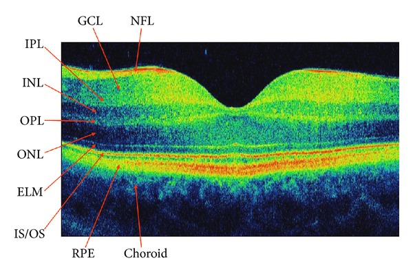 Figure 1