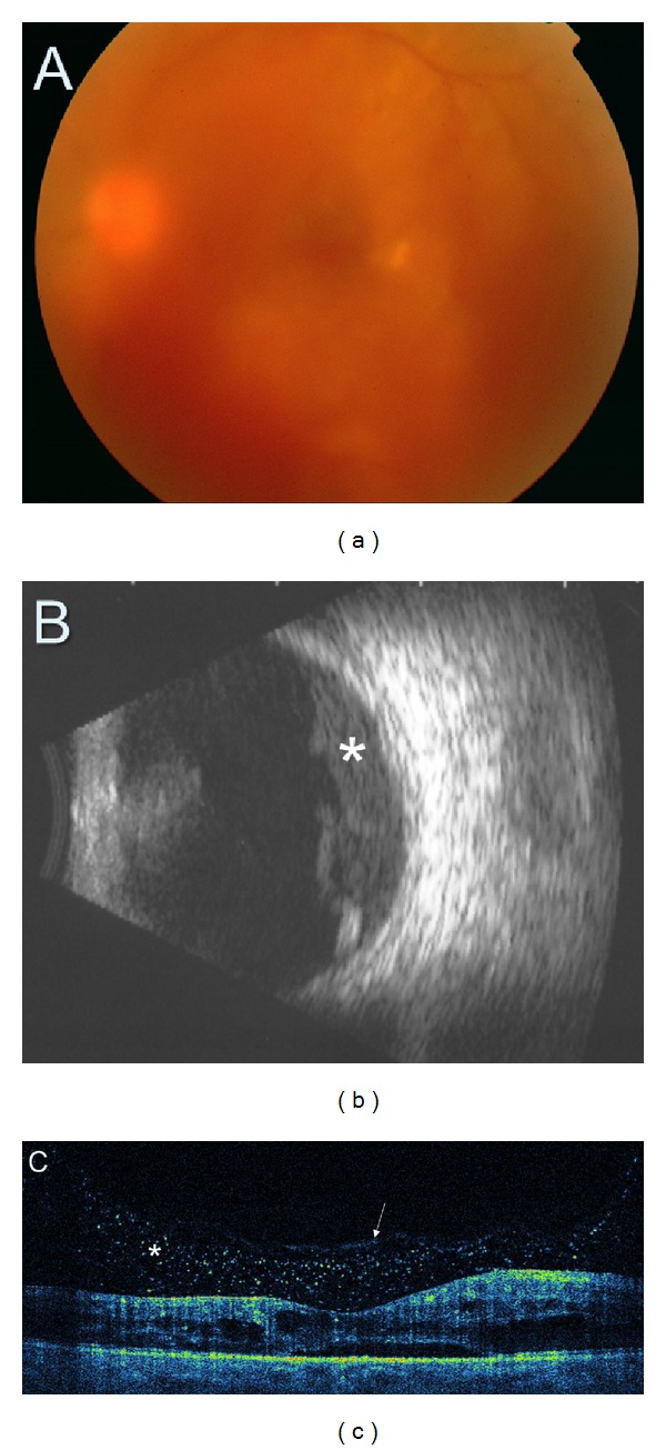 Figure 11