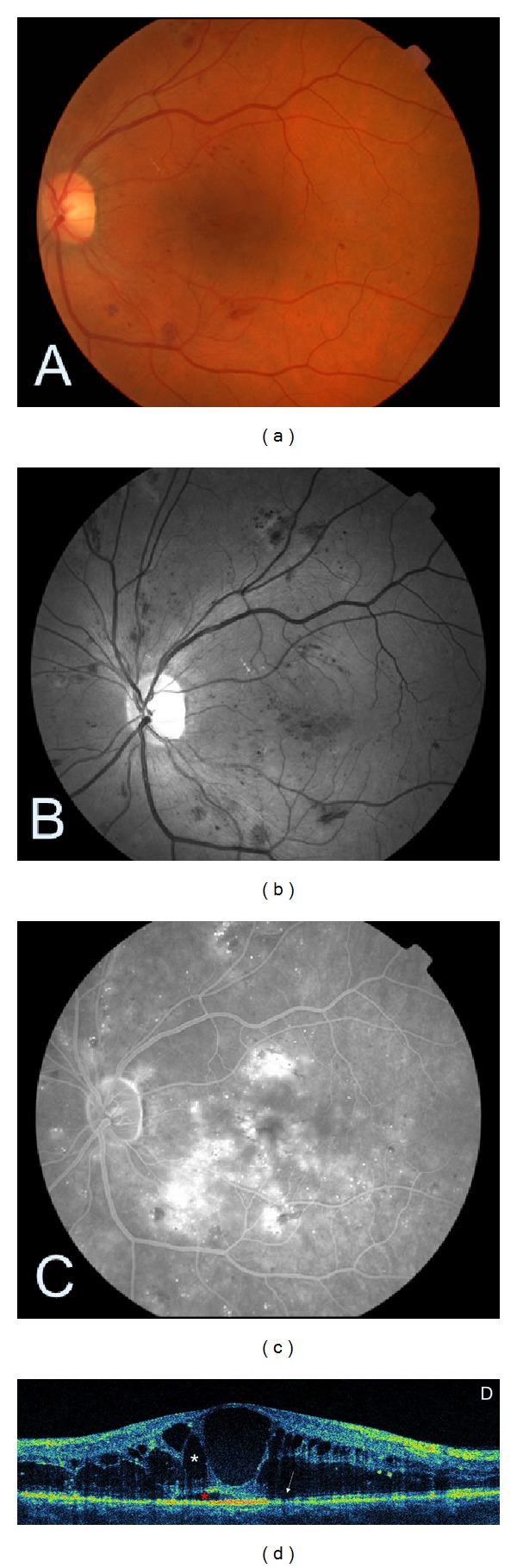 Figure 4