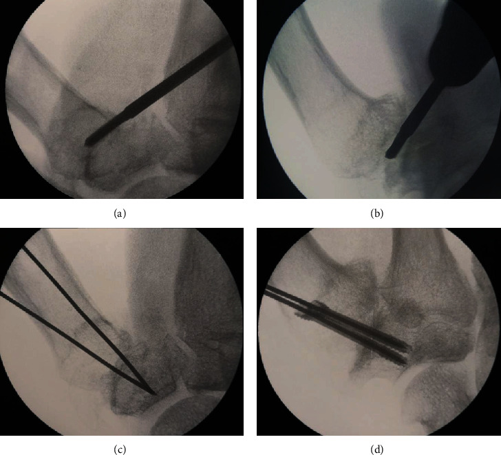 Figure 2