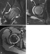 Fig. 11A–C