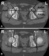 Fig. 8A–B