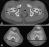 Fig. 10A–B