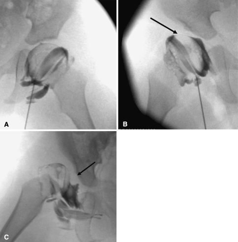 Fig. 5A–C