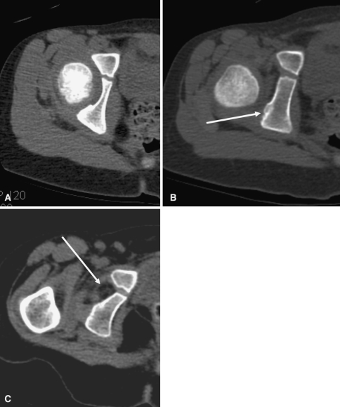 Fig. 7A–C