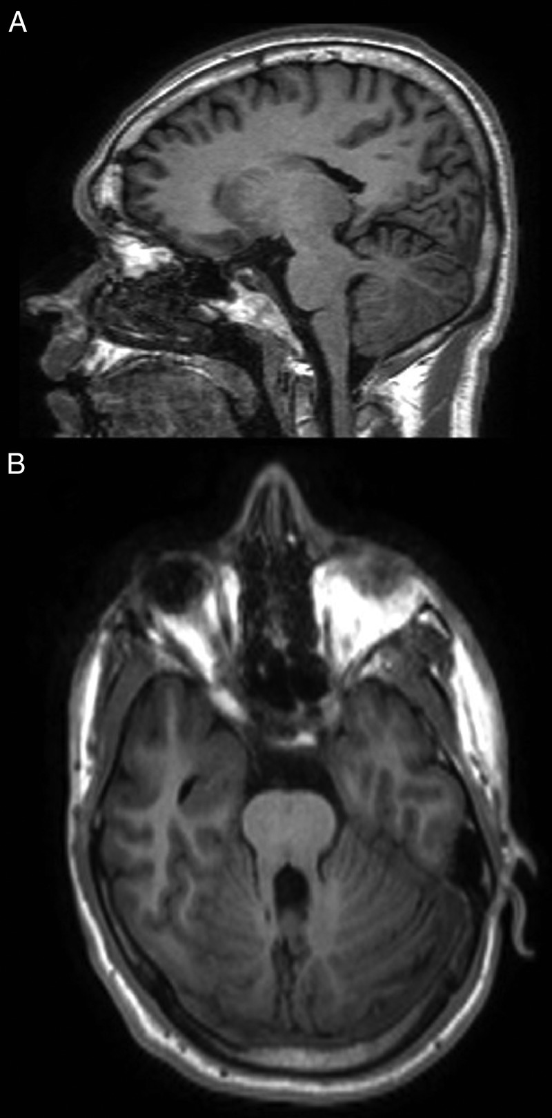 Figure 1