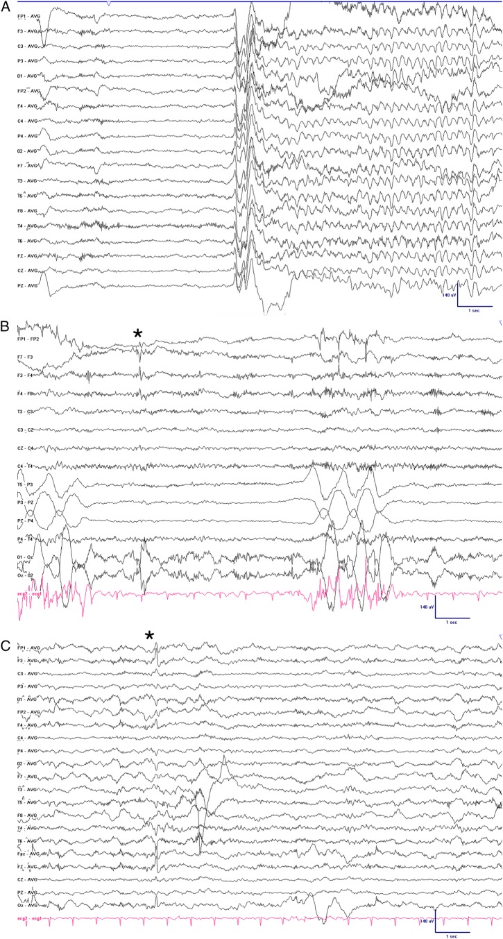 Figure 2