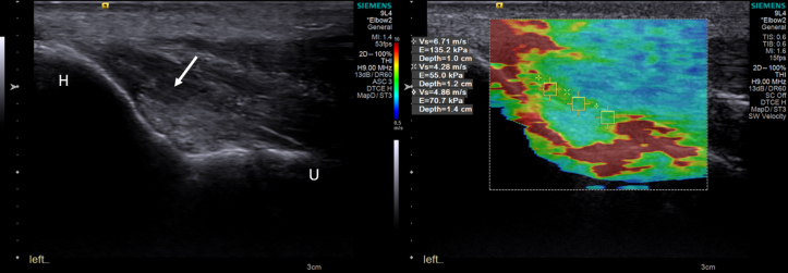 Figure 2