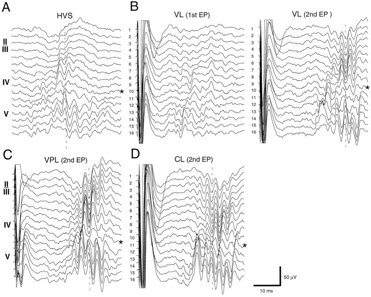 Fig. 11.