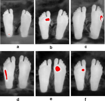 Fig. 12