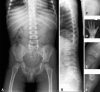 Fig. 1A–F