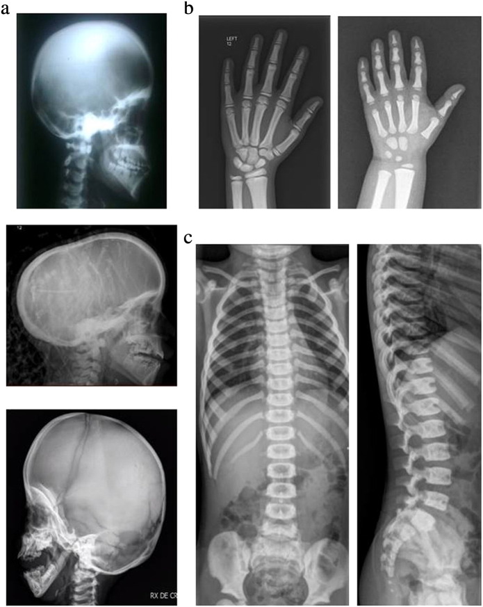 Fig. 1