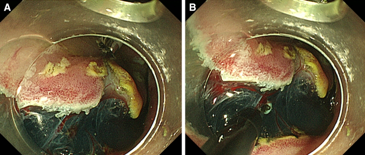 Fig. 4