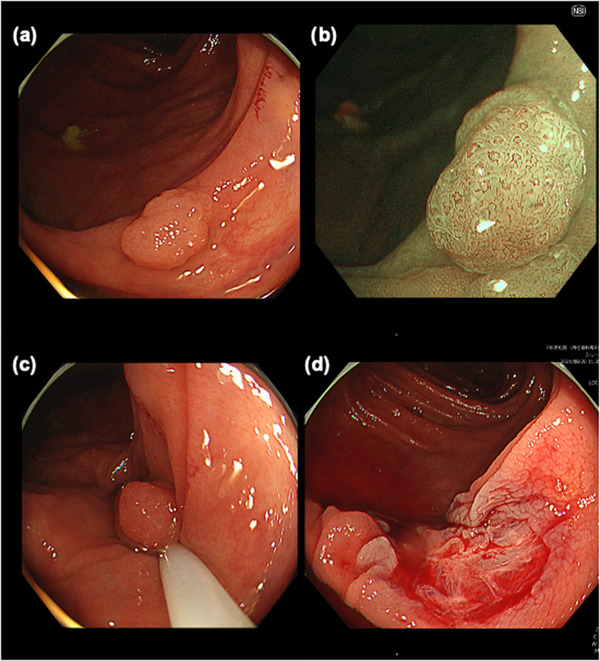 FIGURE 1