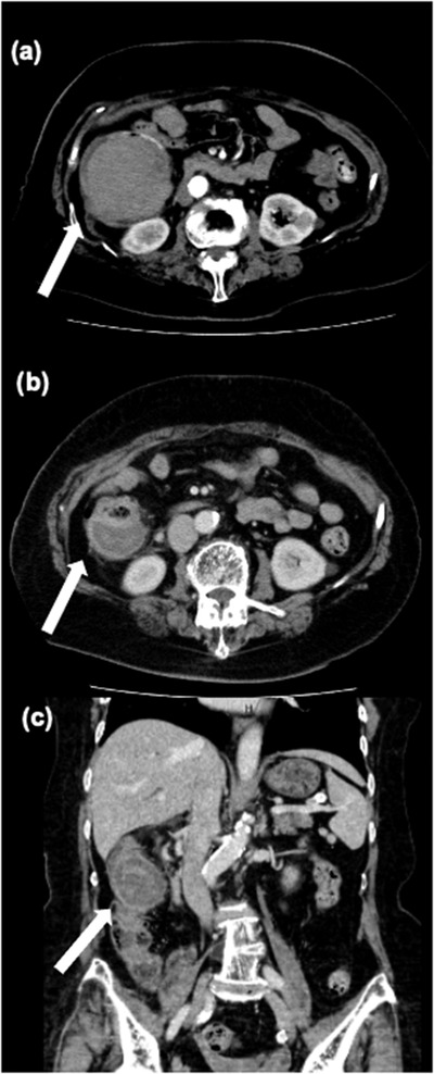 FIGURE 4