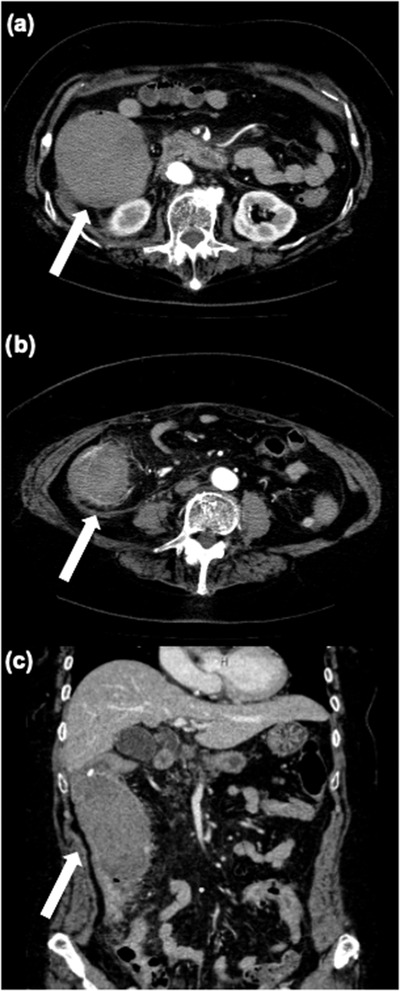 FIGURE 3