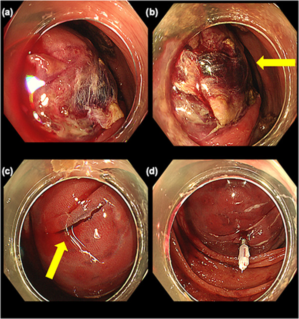 FIGURE 2