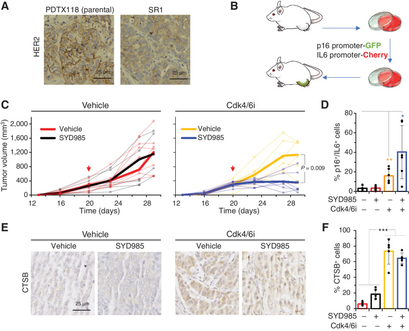 Figure 5. Effect of the combination Cdk4/6i-SYD985 on a PDTXs resistant to SYD985. A, IHC analysis of HER2 in the parental PDTX or SR1, the corresponding resistant PDTX derived from it. B, Schematic showing the generation of SR1 tumors expressing reporters under the control of human p16 or IL6 promoters. Briefly, cells from SR1 were transiently cultured, infected with virus encoding the reporters as described in ref. 25 and reimplanted into immunodeficient mice. C, PDTXs expressing the reporters described in B were implanted into NOD.SCID mice and volumes were monitored periodically. As indicated by the arrow, control group (treated with vehicle) and Cdk4/6i group (treated with palbociclib at 50 mg/kg/day) were treated with 10 mg/kg of SYD985 in single dose fashion. Narrow lines represent the growth of individual tumors, wide lines represent averages. D, At the end of the experiment, the number of double-positive cells for IL6 and p16 was quantified from independent tumors by flow cytometry; n = 5. E and F, IHC analysis of CTSB in tumors treated as in C. Results from five different fields were quantified and the results are shown as averages ± SD.