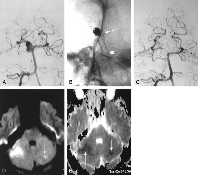 Fig 2.