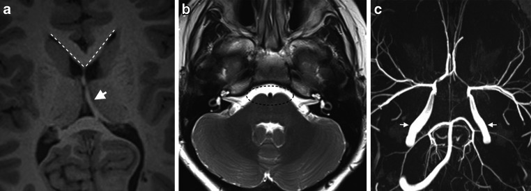 Fig. 11