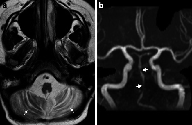 Fig. 10