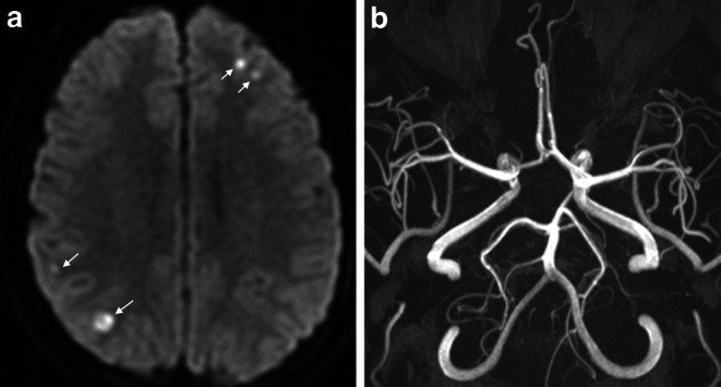Fig. 3