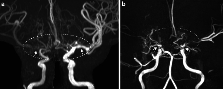 Fig. 12