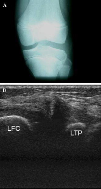 Fig. 1