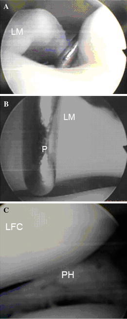 Fig. 3