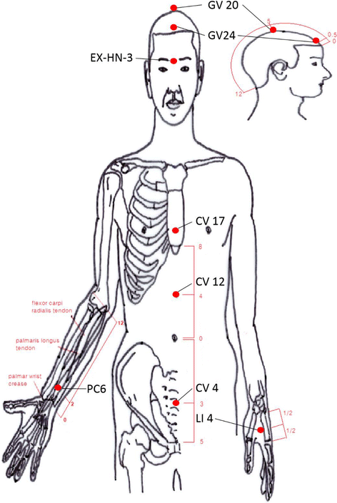 Fig. 2