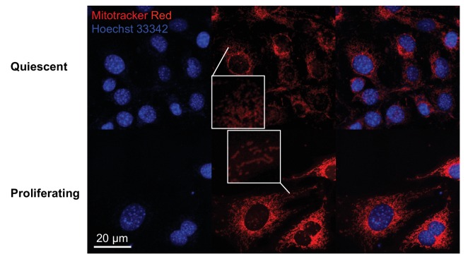 Figure 2—figure supplement 1.