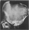 68