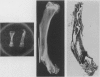 81