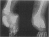79
