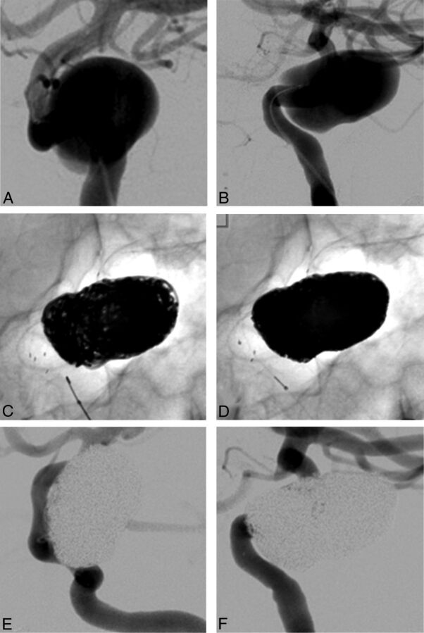 Fig 3.