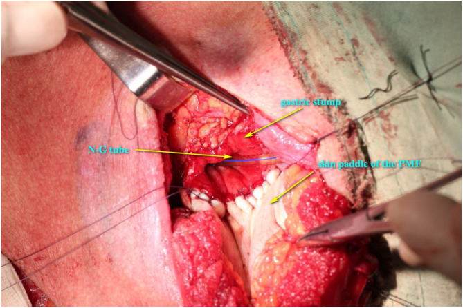 Figure 6