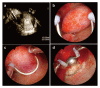 Fig. 1.