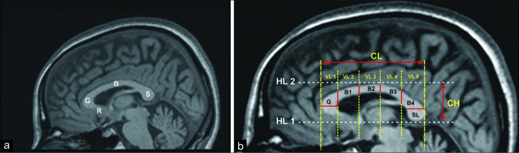 Figure 1: