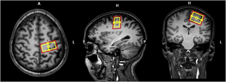 Fig. 1