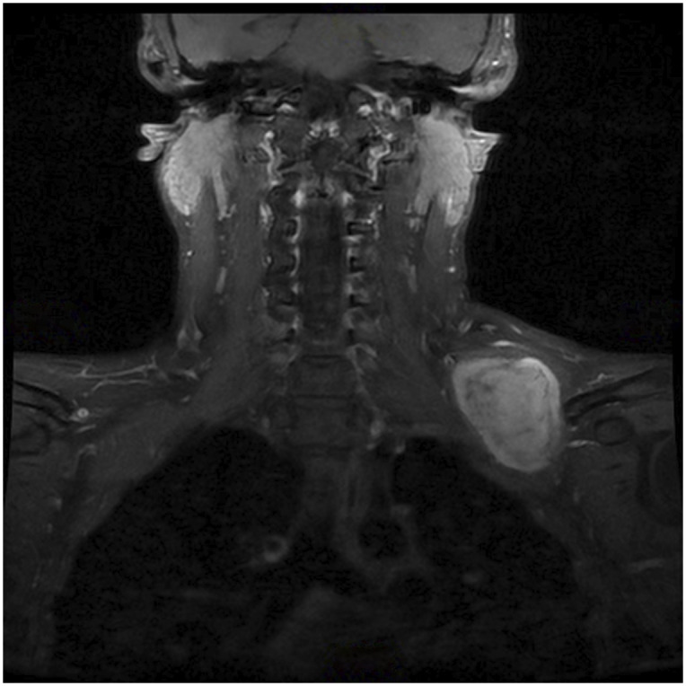 Fig. 1-A