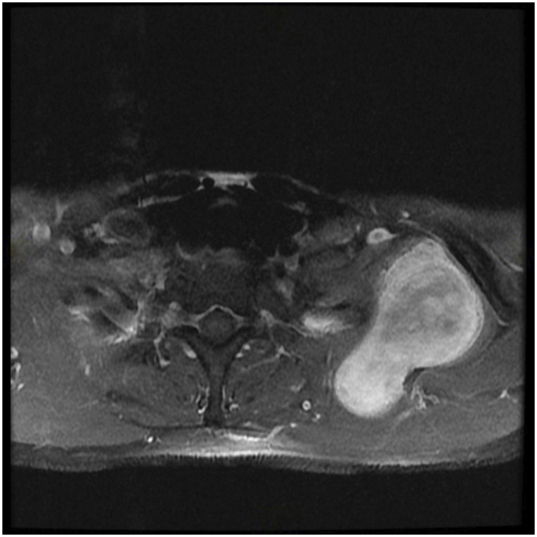 Fig. 1-C