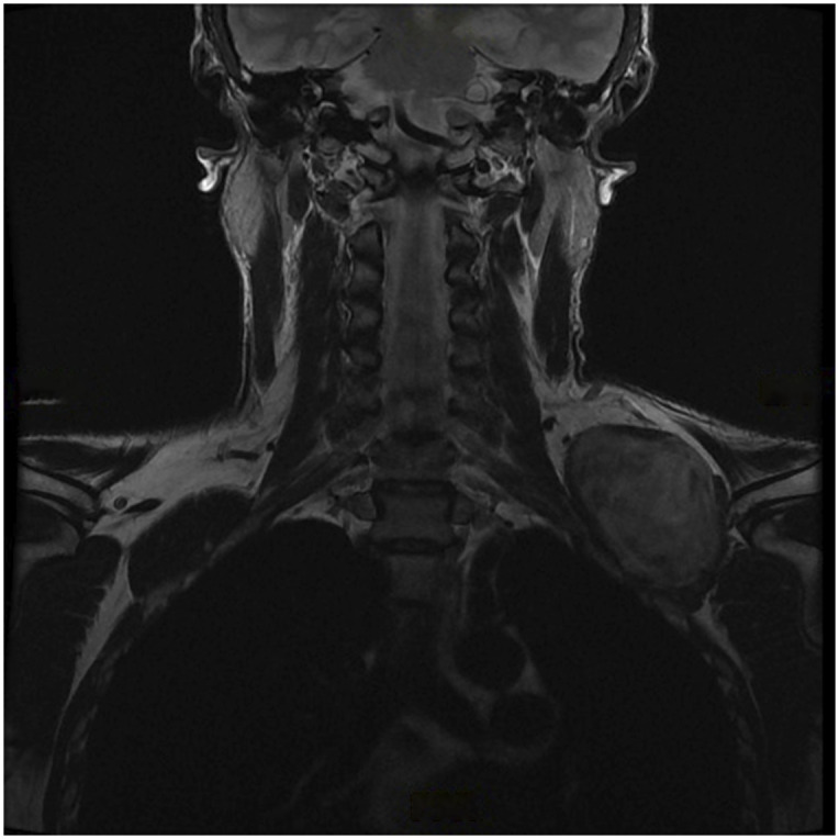 Fig. 1-B