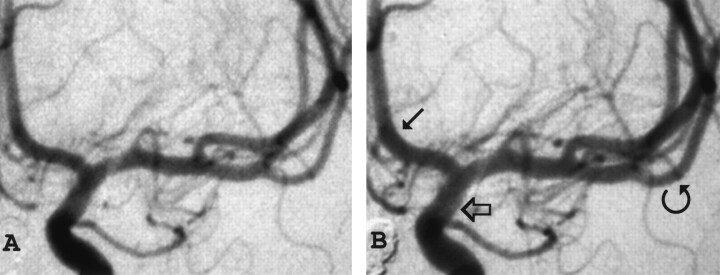 Fig 2.