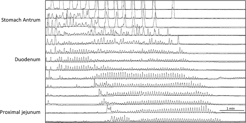 Fig. 2