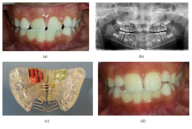 Figure 2